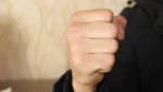 За драку придется заплатить: гайчанин возместит страховой компании расходы на лечение пострадавшего